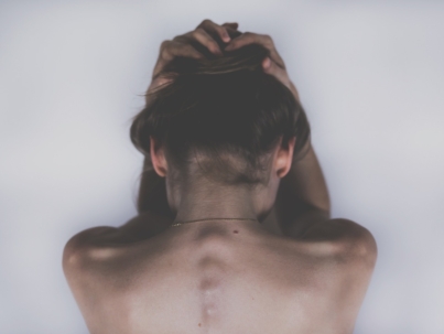 Que es la Epilepsia - Causas y demas