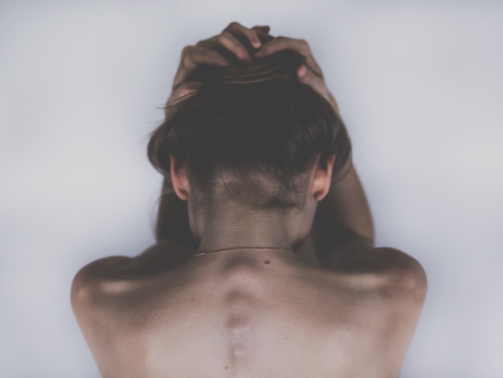 Que es la Epilepsia - Causas y demas